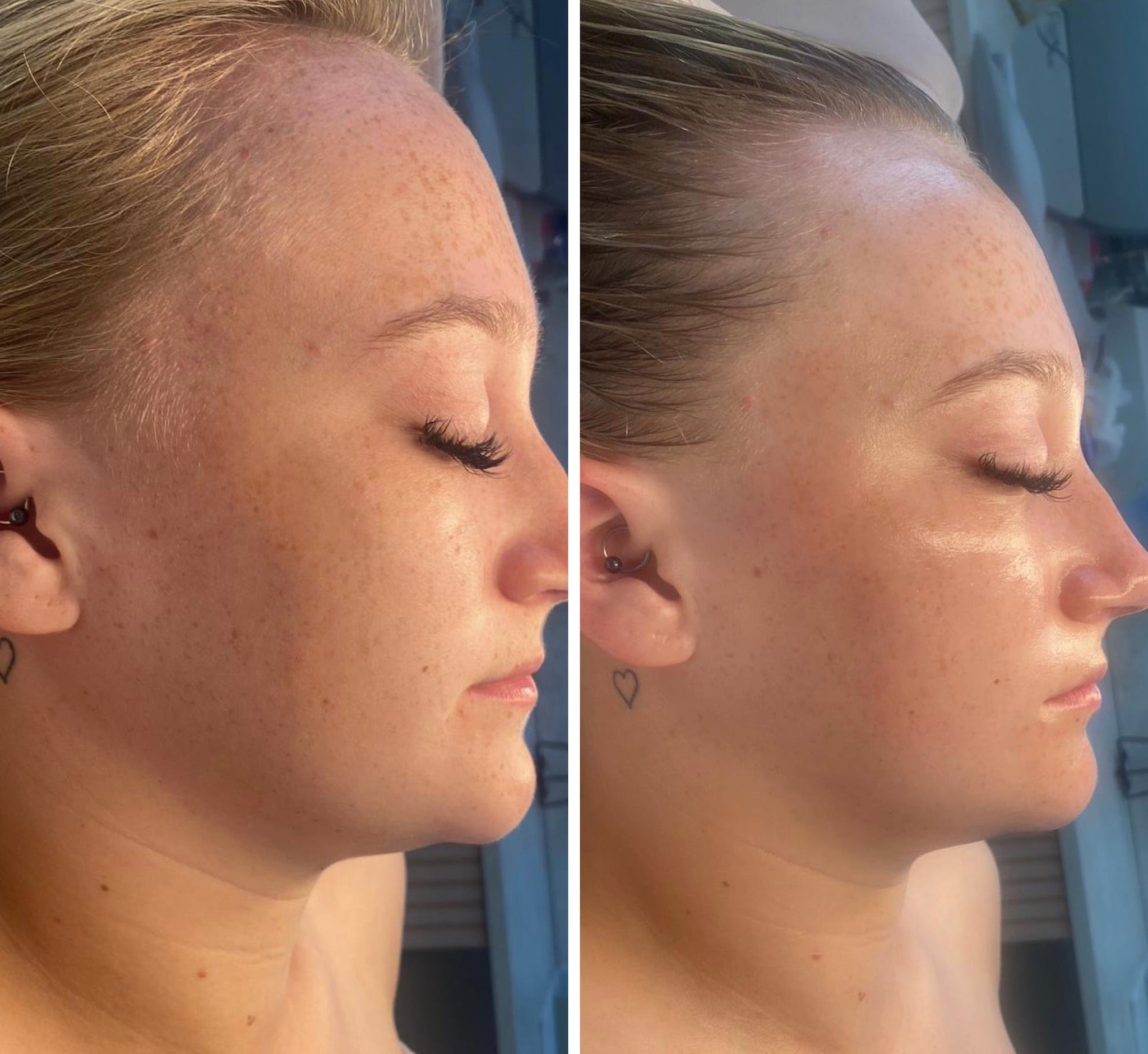 Lymphatic Correction Course