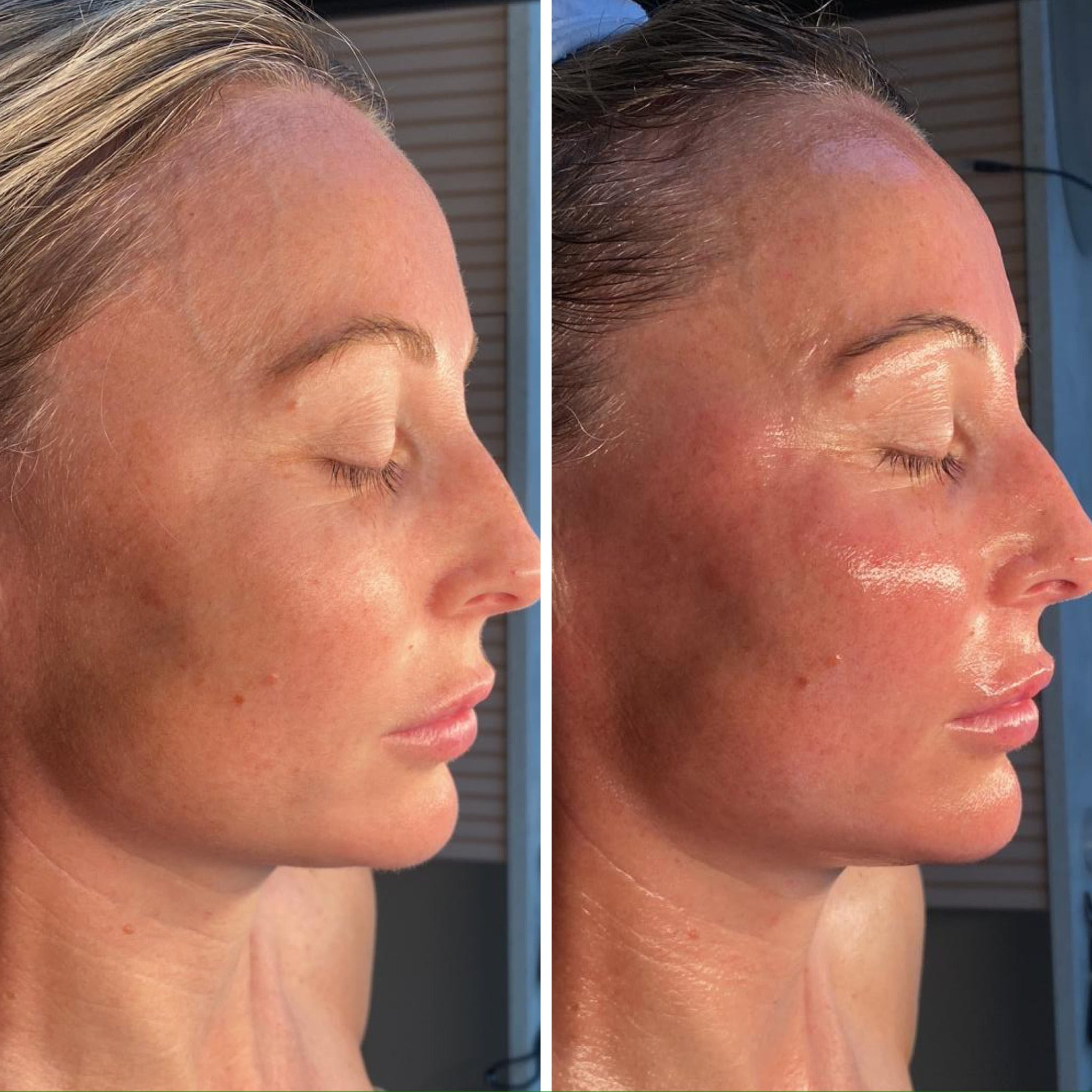 The Quick Fix Glow Up