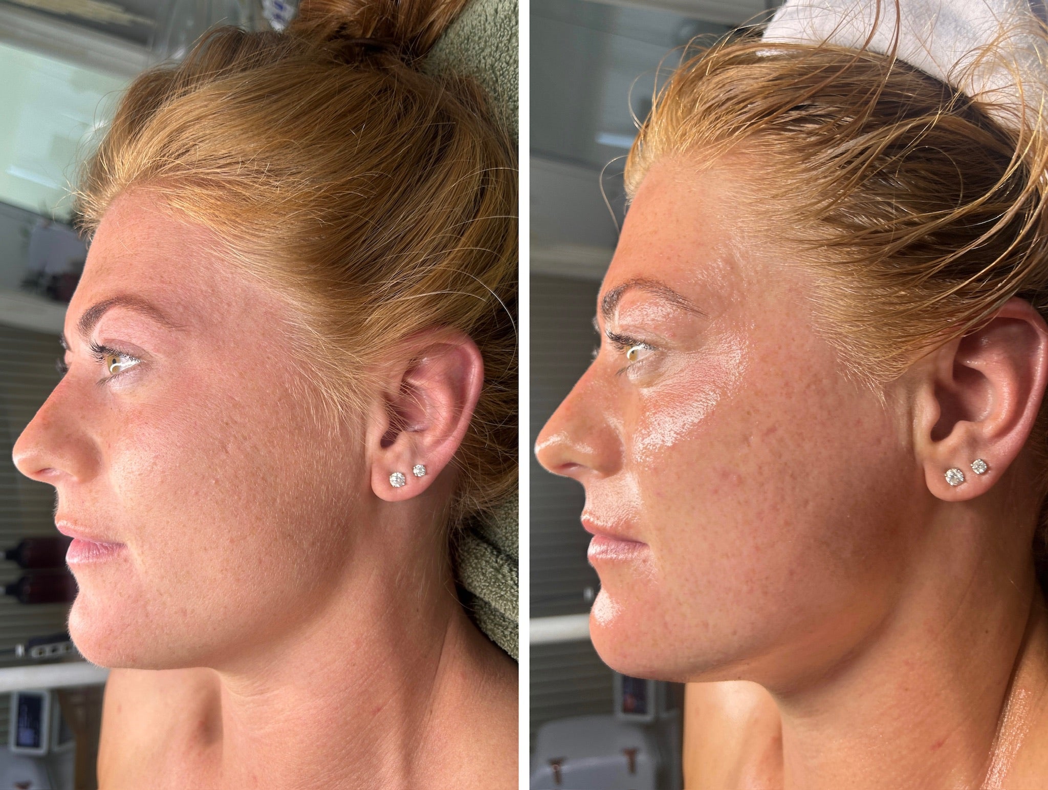 Lymphatic Correction Course