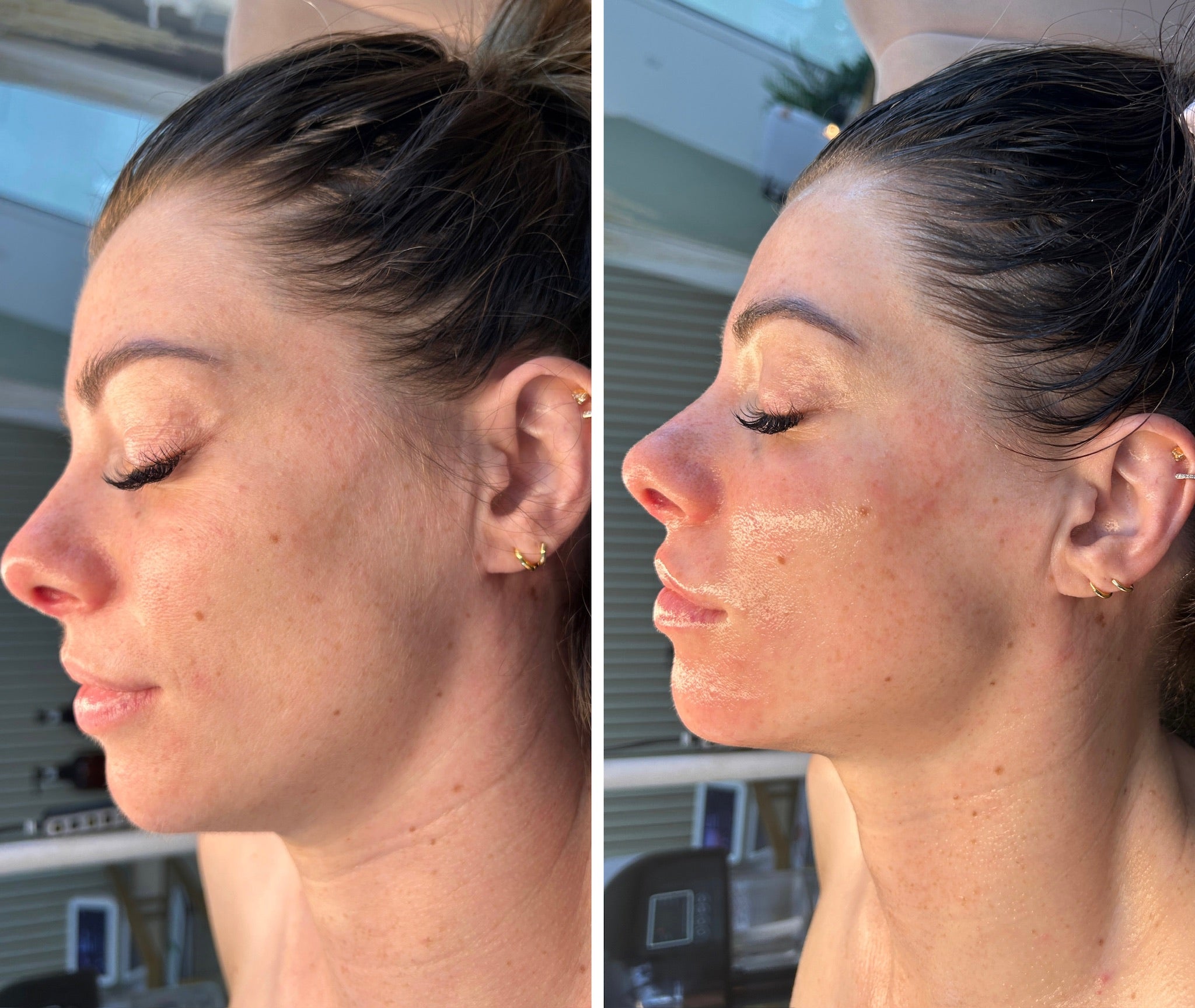 Lymphatic Correction Course