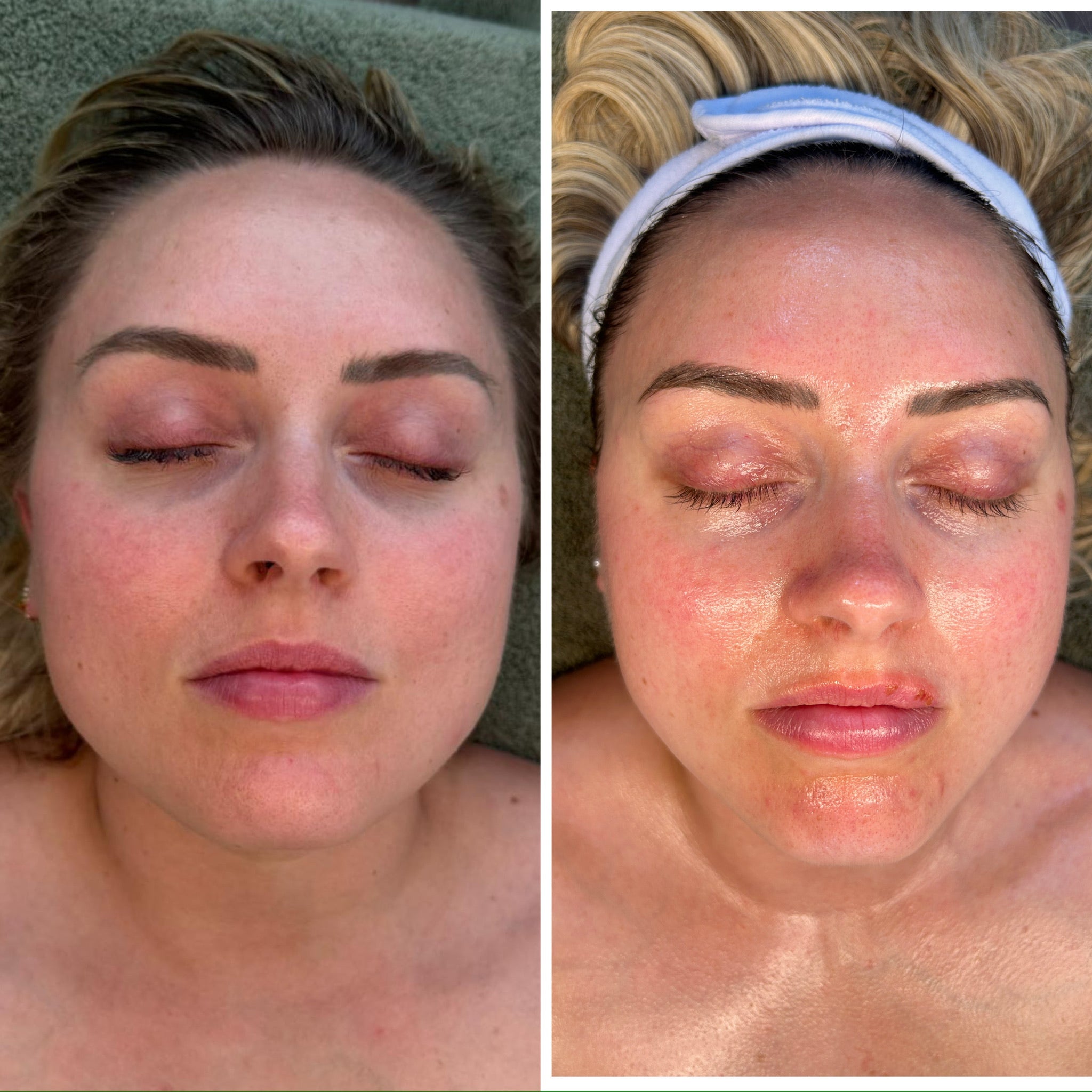 The Quick Fix Glow Up