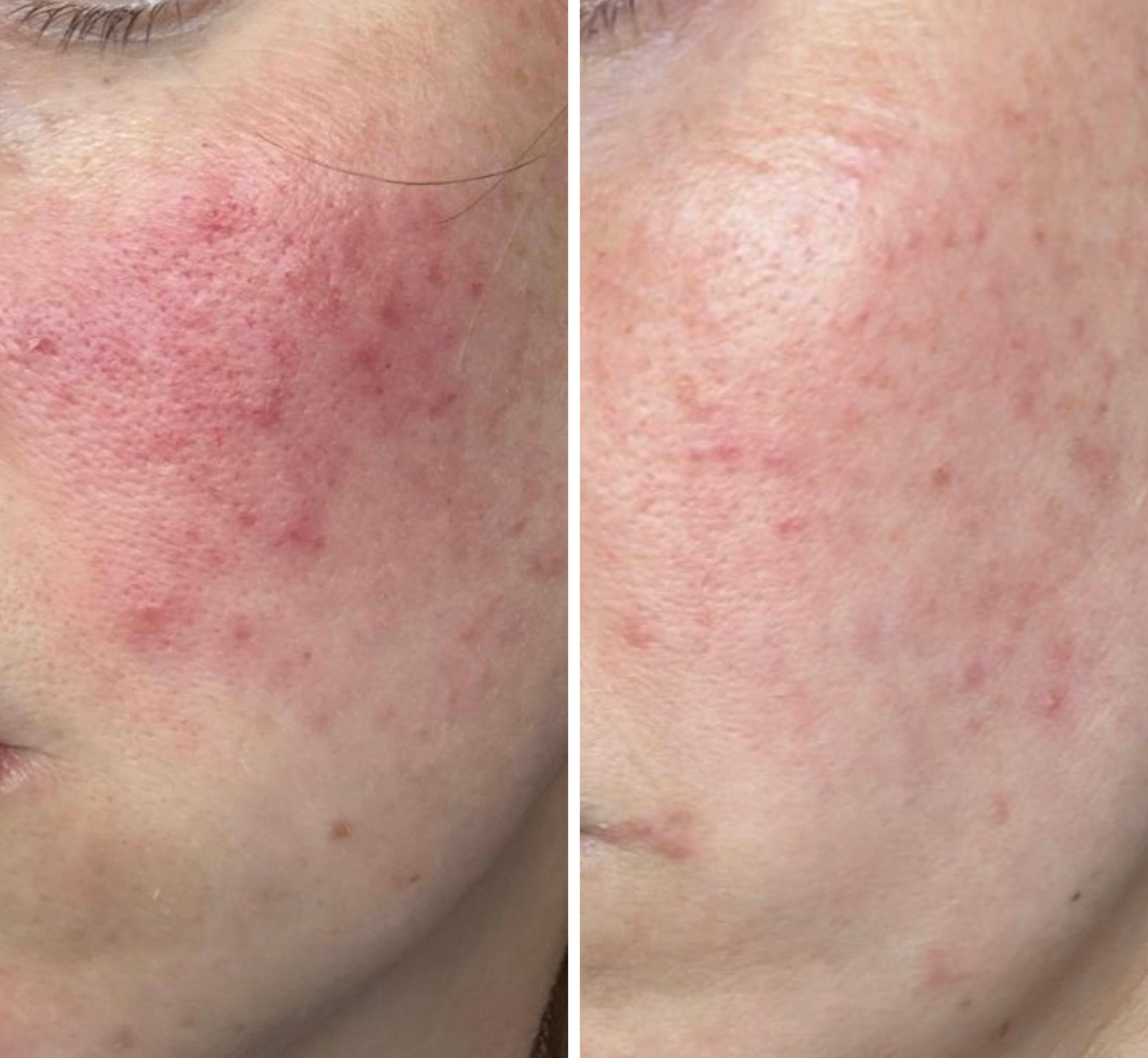 Ultimate Skin Rejuvenation Ritual