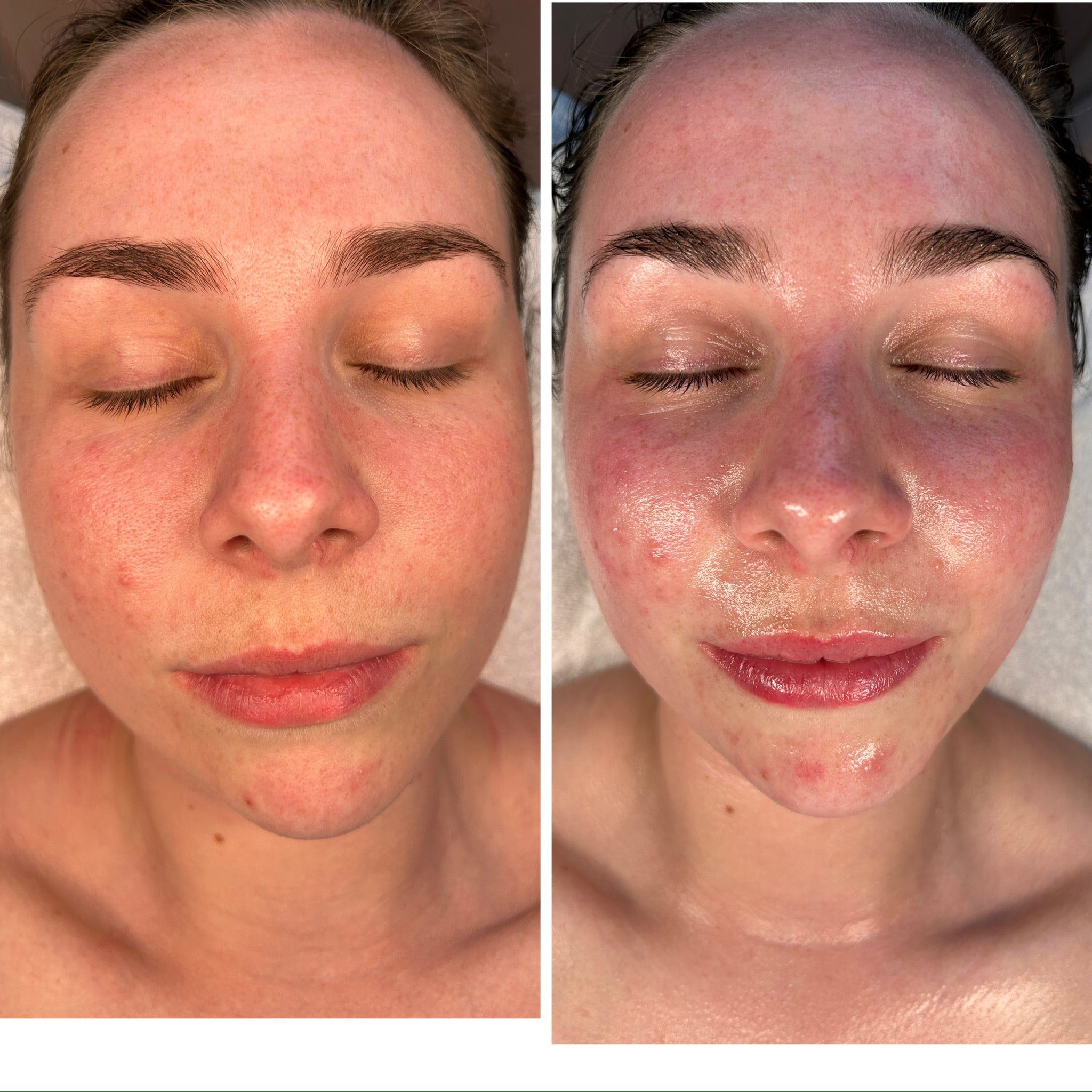 Lymphatic Correction Course