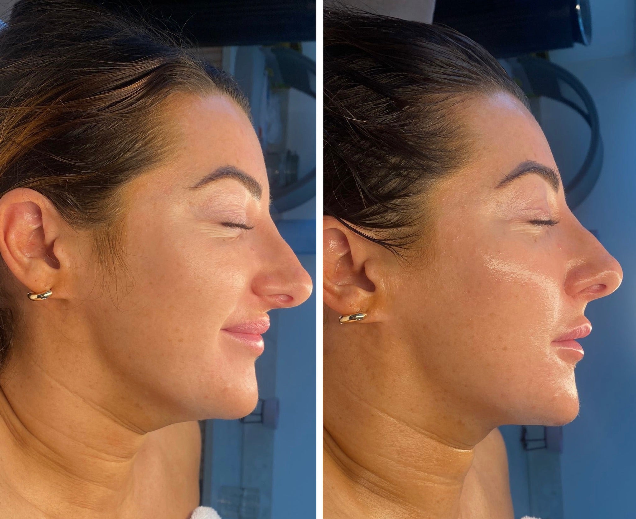 Lymphatic Correction Course