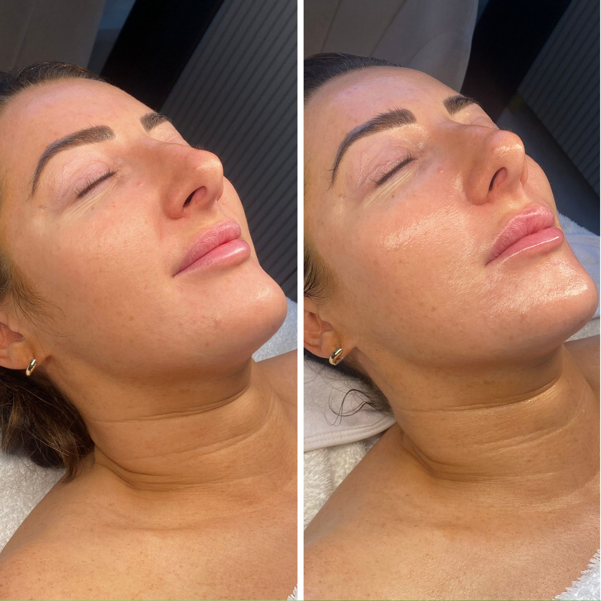 Lymphatic Correction Course