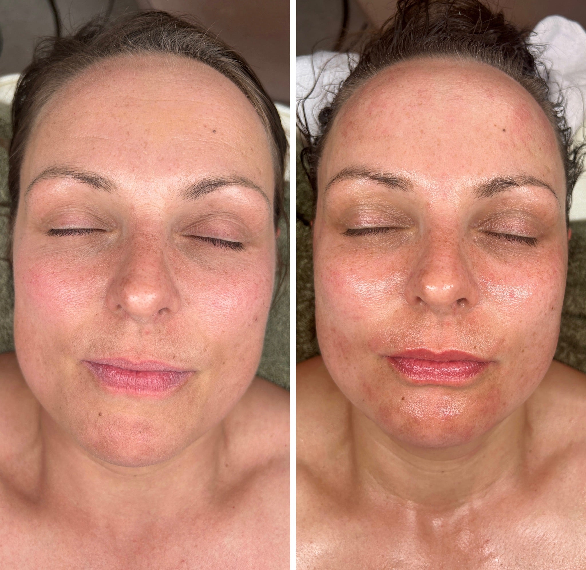 Lymphatic Correction Course