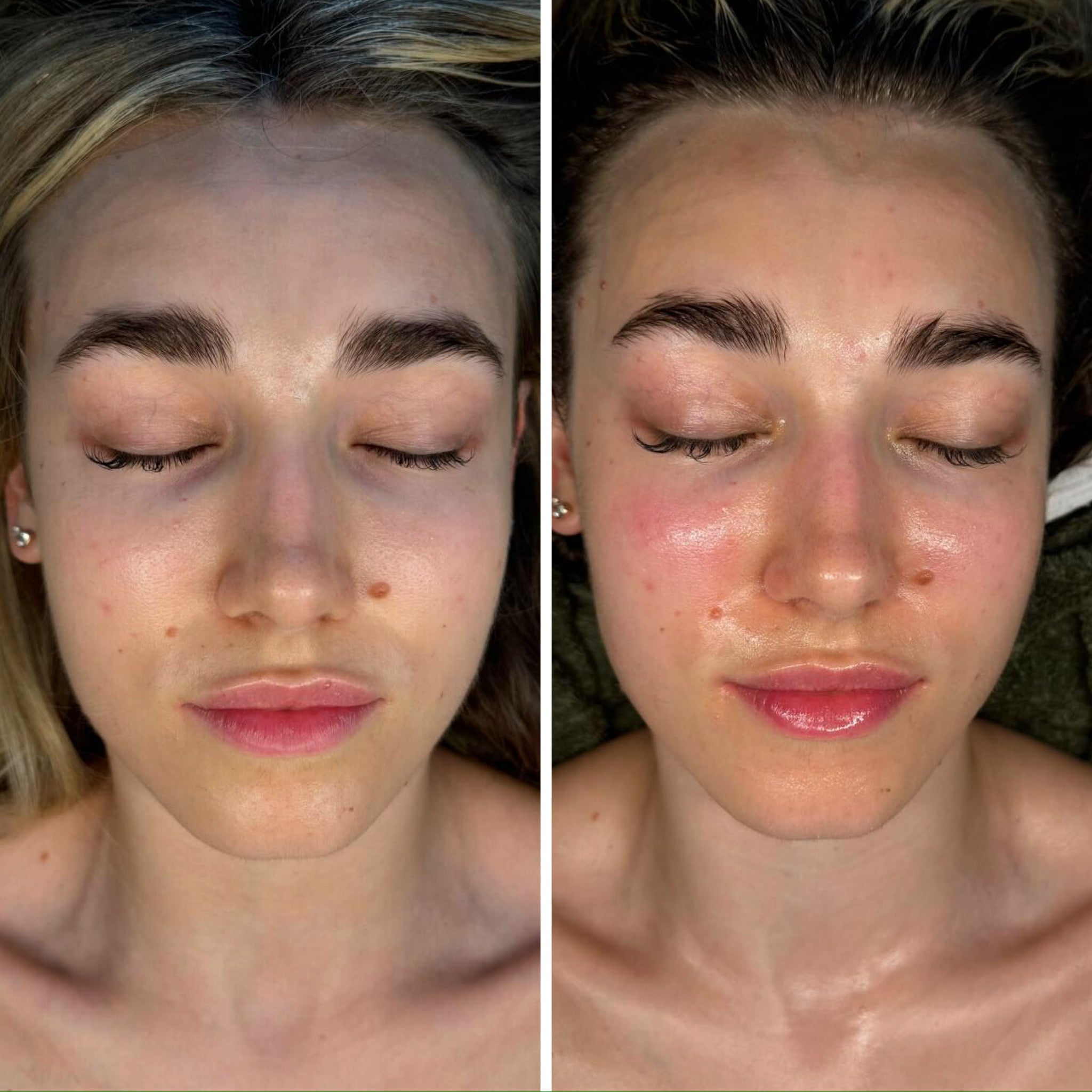 Lymphatic Correction Course