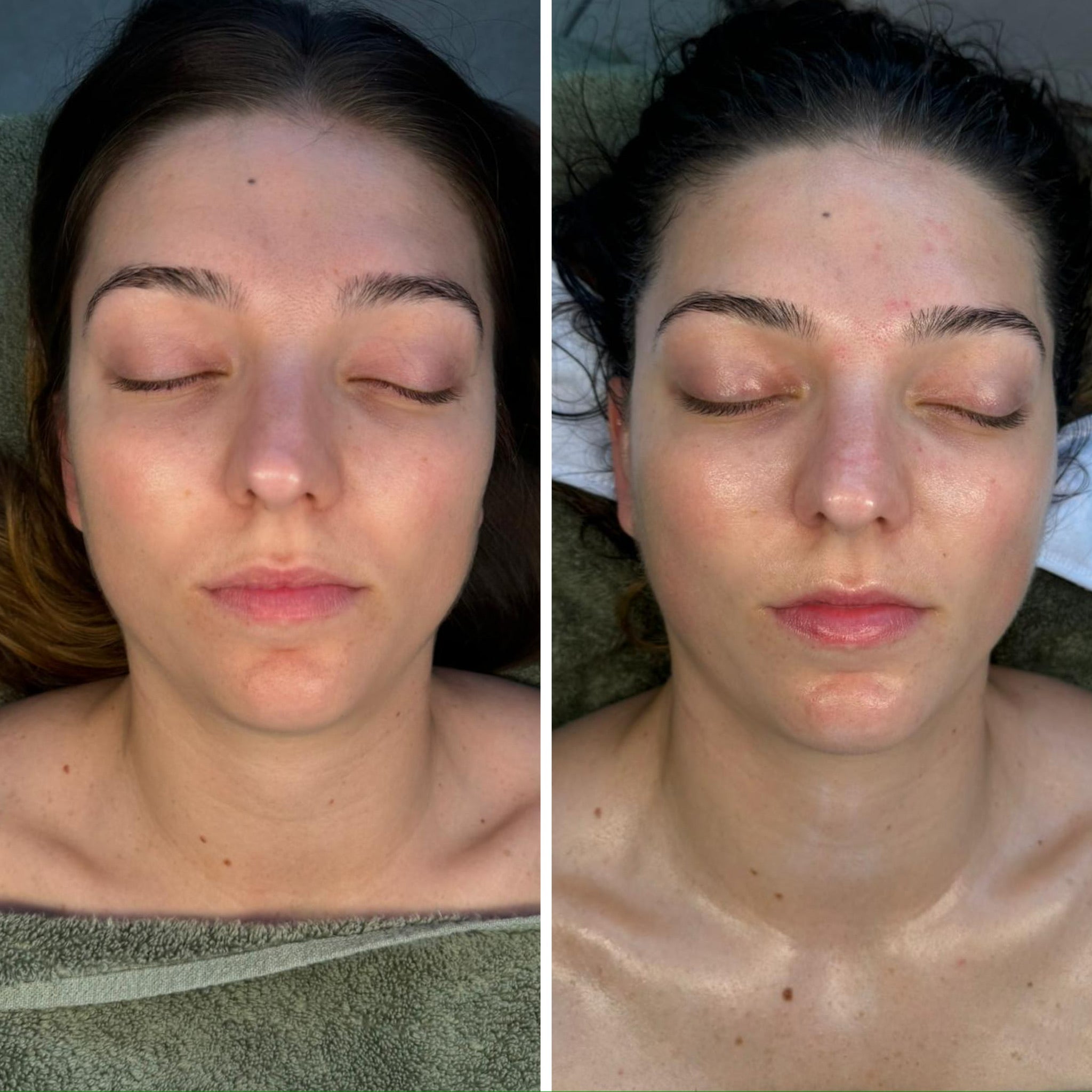 Lymphatic Correction Course