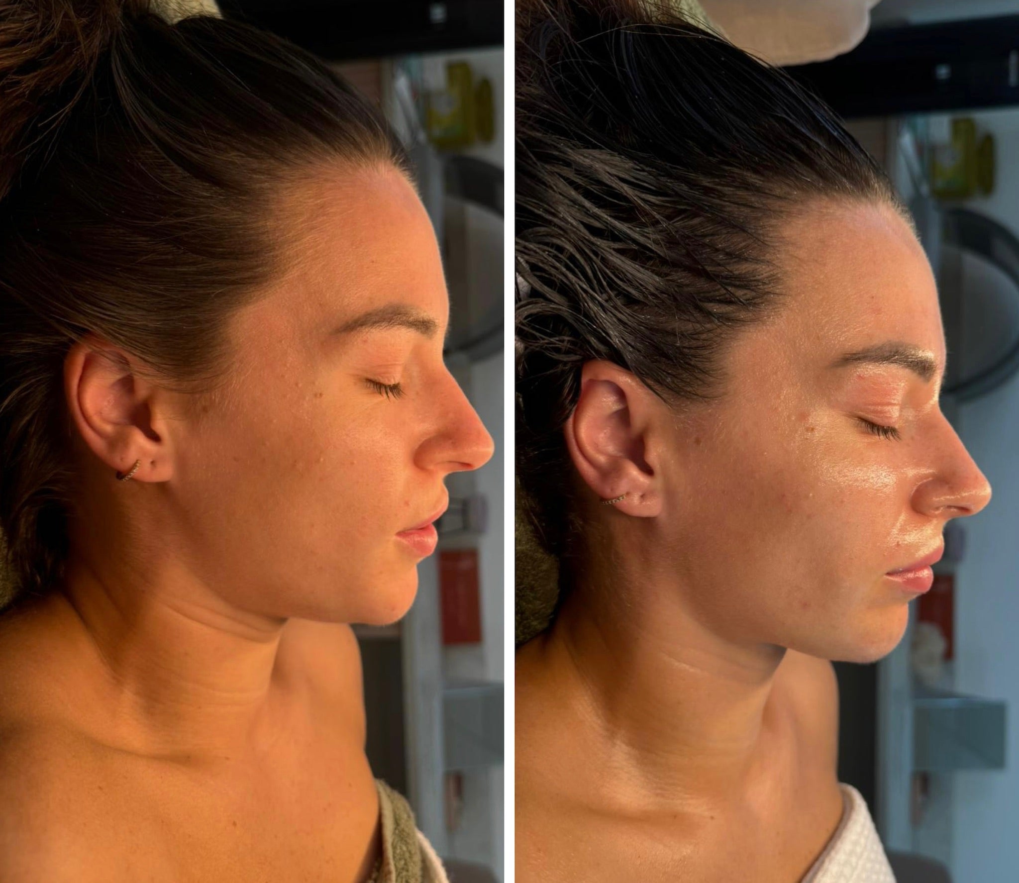 Luxury Lymphatic Lift facial