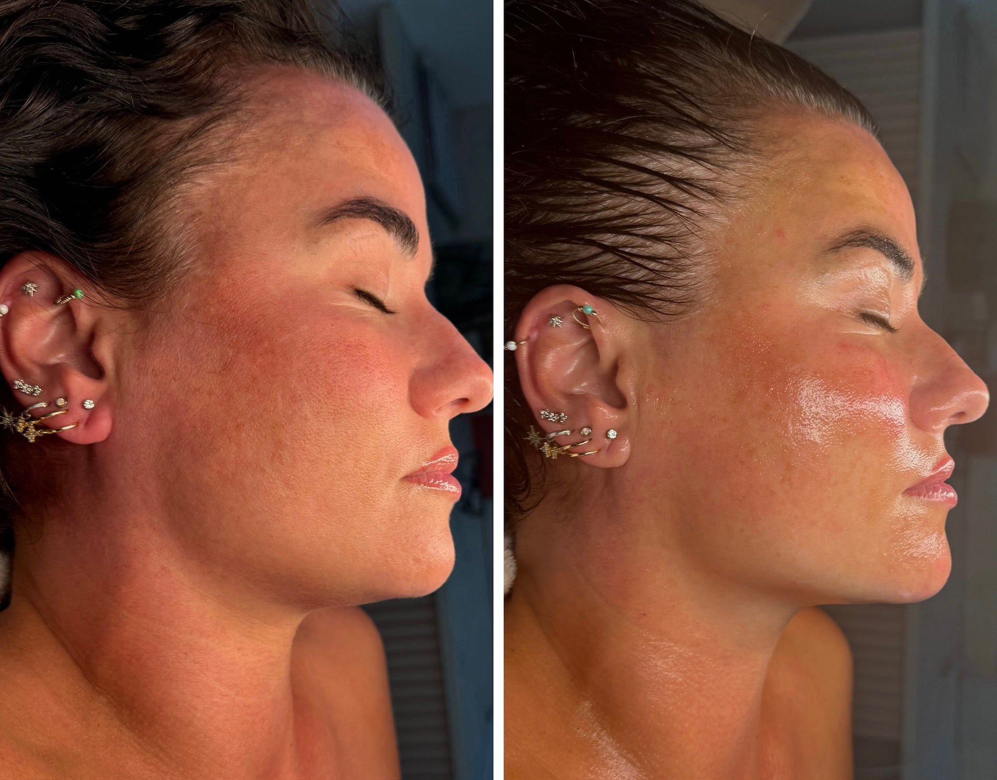 Luxury Lymphatic Lift facial